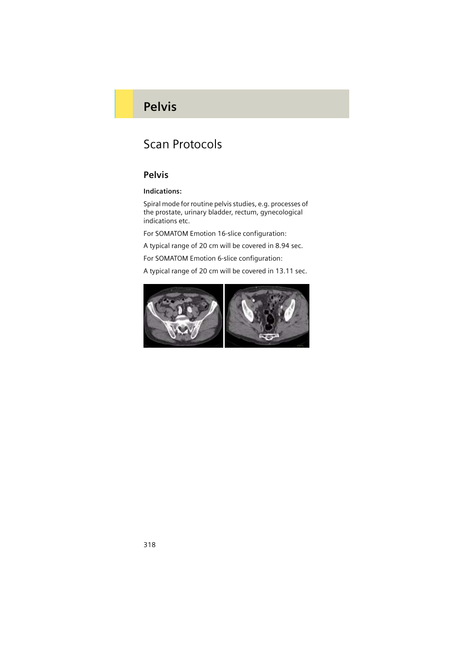 Scan protocols, Pelvis, Pelvis 318 | Pelvis scan protocols | Siemens EMOTION 16-Jun User Manual | Page 318 / 590