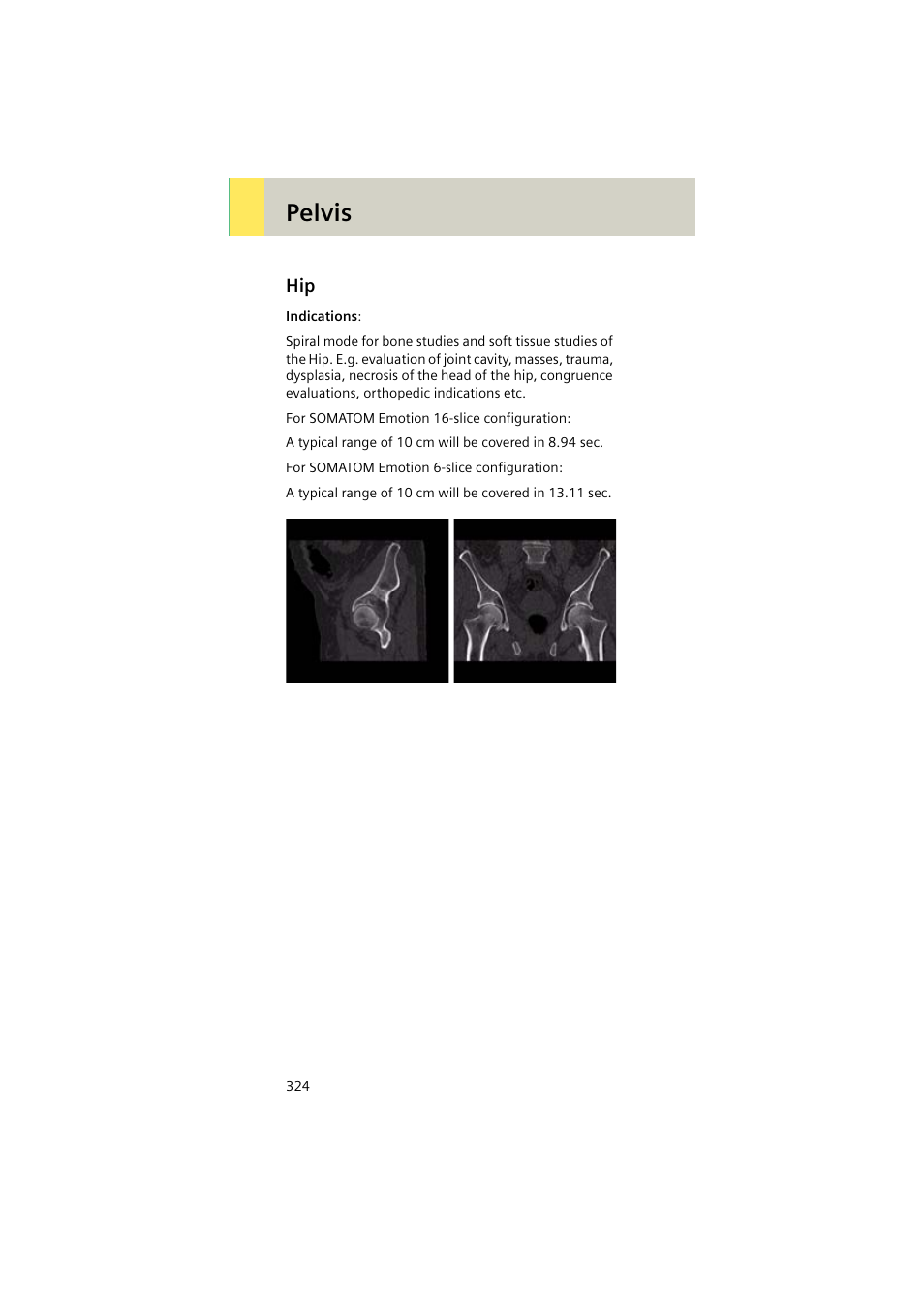 Hip 324, Pelvis | Siemens EMOTION 16-Jun User Manual | Page 324 / 590