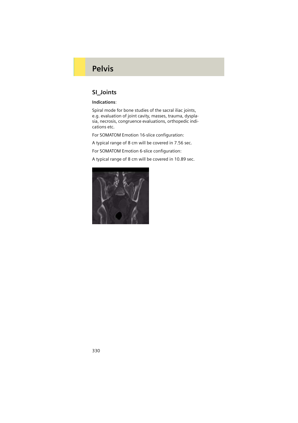 Si_joints, Si_joints 330, Pelvis | Siemens EMOTION 16-Jun User Manual | Page 330 / 590