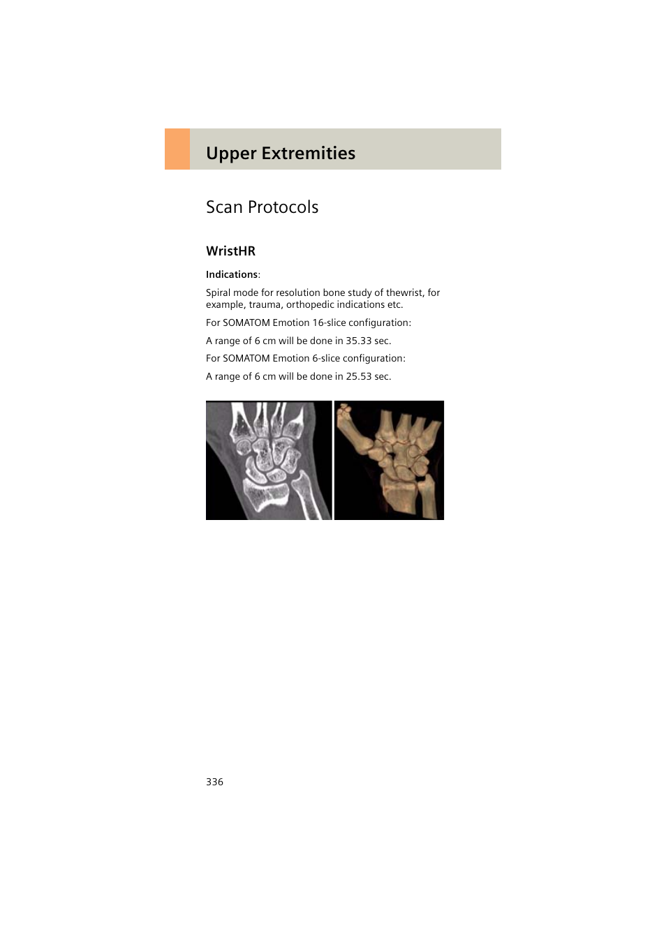 Scan protocols, Wristhr, Wristhr 336 | Upper extremities scan protocols | Siemens EMOTION 16-Jun User Manual | Page 336 / 590