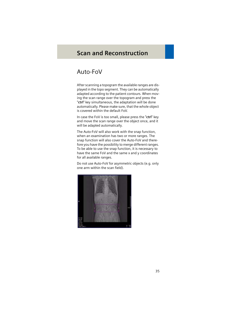 Auto-fov, Scan and reconstruction | Siemens EMOTION 16-Jun User Manual | Page 35 / 590