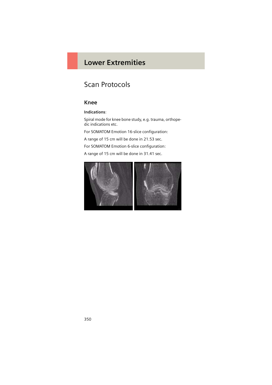 Scan protocols, Knee, Knee 350 | Lower extremities scan protocols | Siemens EMOTION 16-Jun User Manual | Page 350 / 590