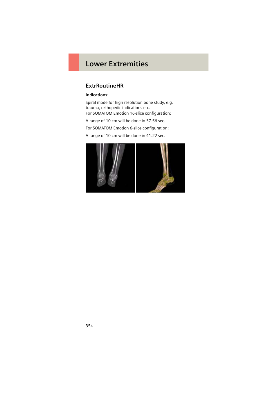 Extrroutinehr, Extrroutinehr 354, Lower extremities | Siemens EMOTION 16-Jun User Manual | Page 354 / 590