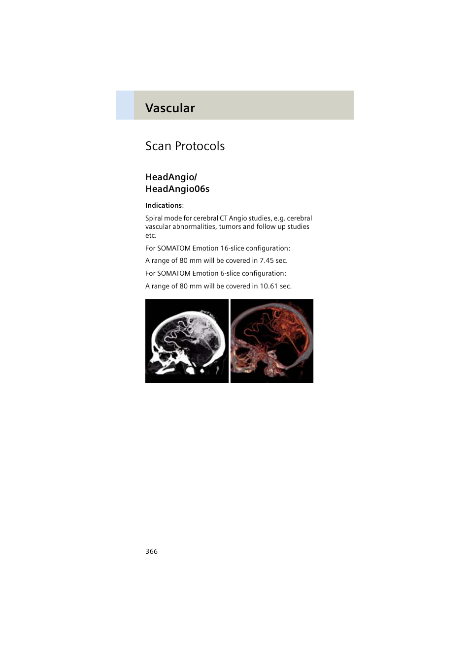 Scan protocols, Headangio/ headangio06s, Headangio | Headangio06s 366, Vascular scan protocols | Siemens EMOTION 16-Jun User Manual | Page 366 / 590