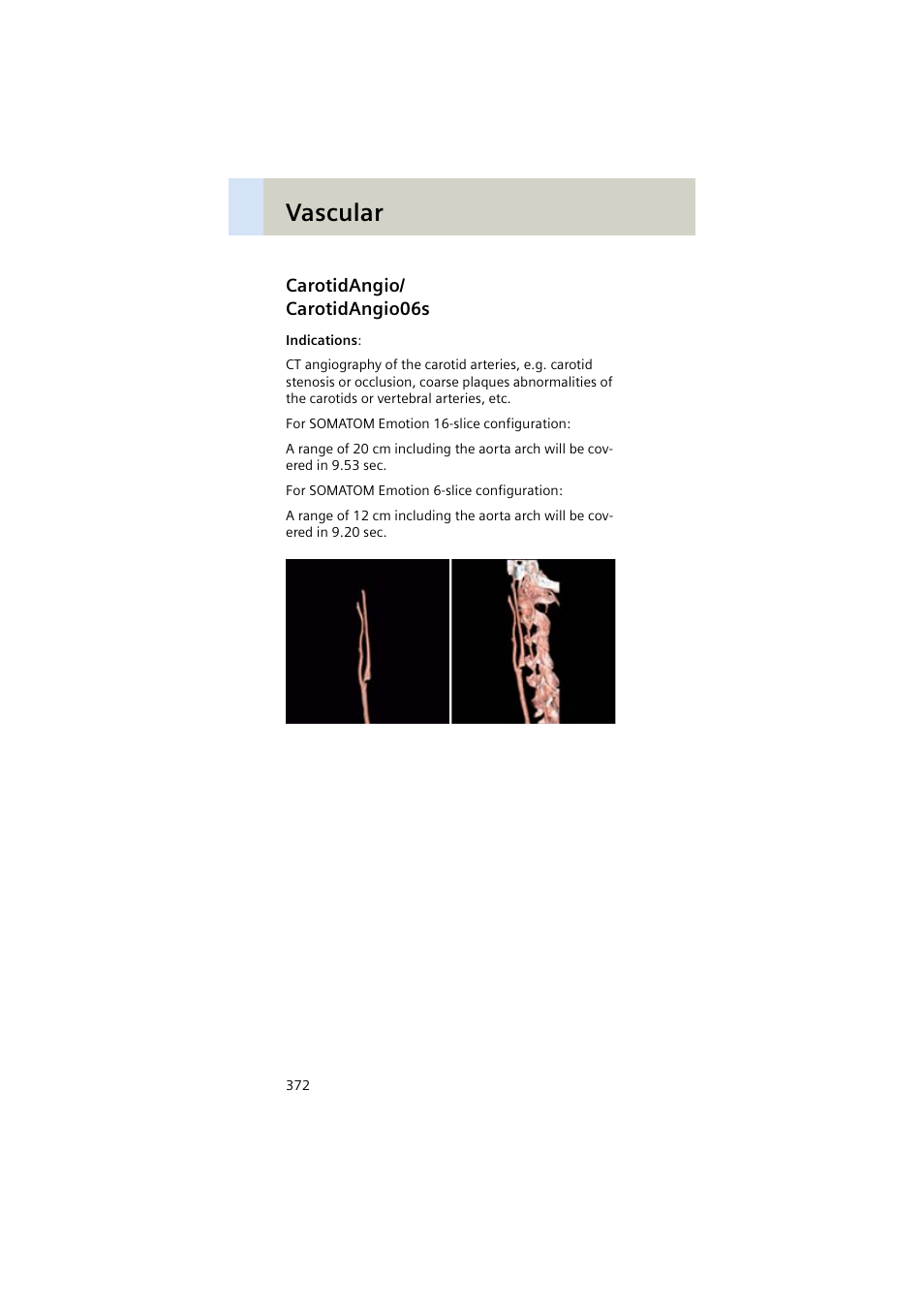 Carotidangio/ carotidangio06s, Carotidangio, Carotidangio06s 372 | Vascular | Siemens EMOTION 16-Jun User Manual | Page 372 / 590