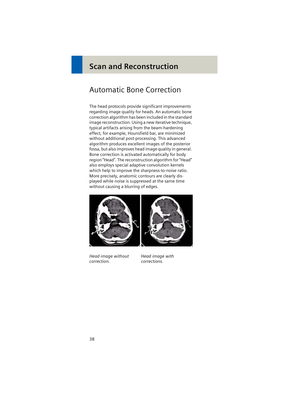 Automatic bone correction, Scan and reconstruction automatic bone correction | Siemens EMOTION 16-Jun User Manual | Page 38 / 590