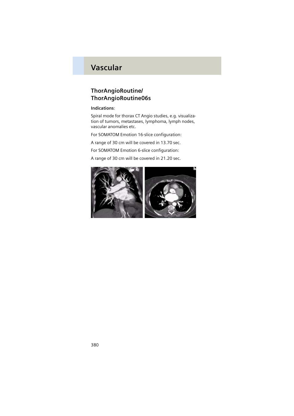 Thorangioroutine/ thorangioroutine06s, Thorangioroutine, Thorangioroutine06s 380 | Vascular | Siemens EMOTION 16-Jun User Manual | Page 380 / 590