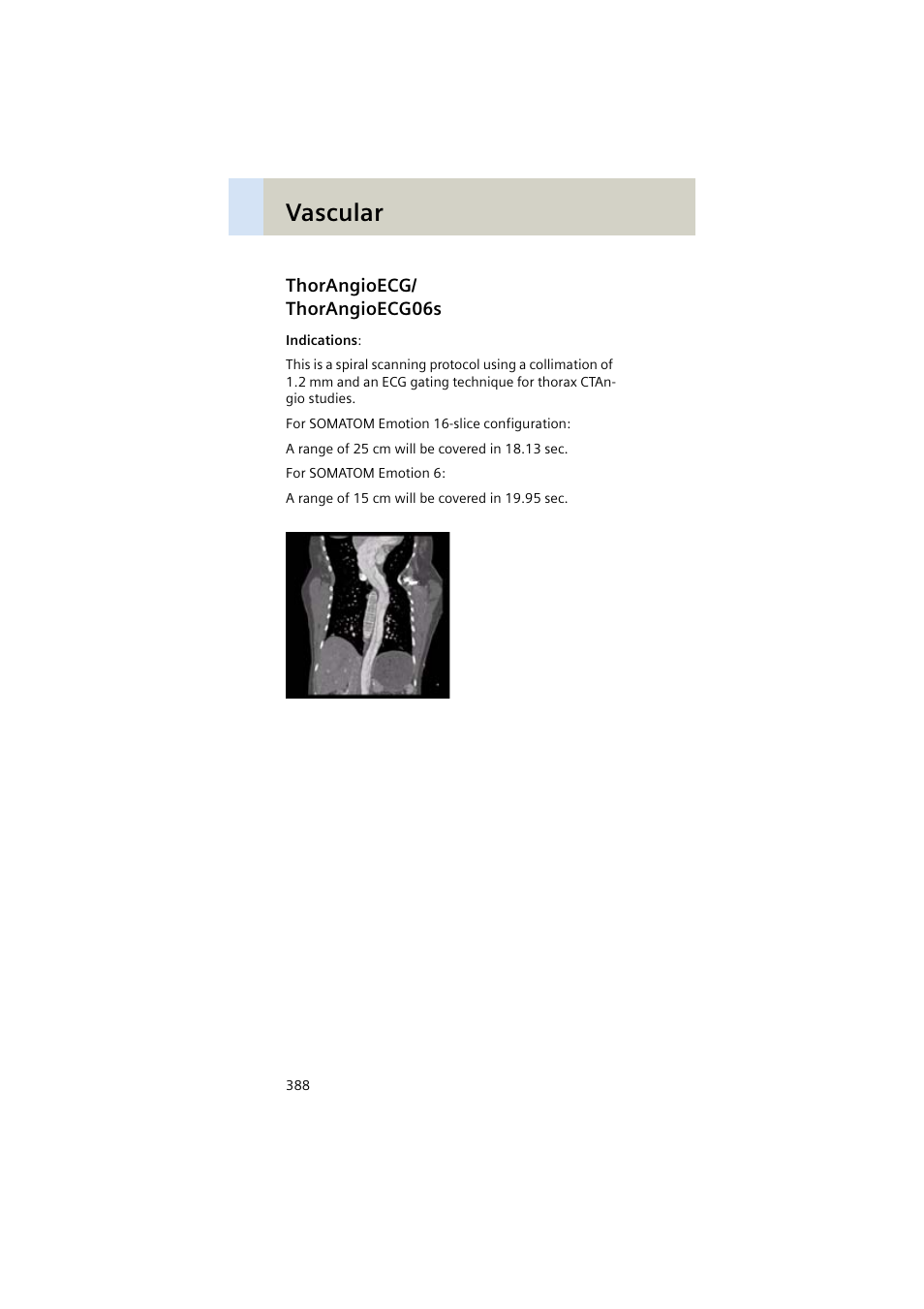 Thorangioecg/ thorangioecg06s, Thorangioecg, Thorangioecg06s 388 | Vascular | Siemens EMOTION 16-Jun User Manual | Page 388 / 590