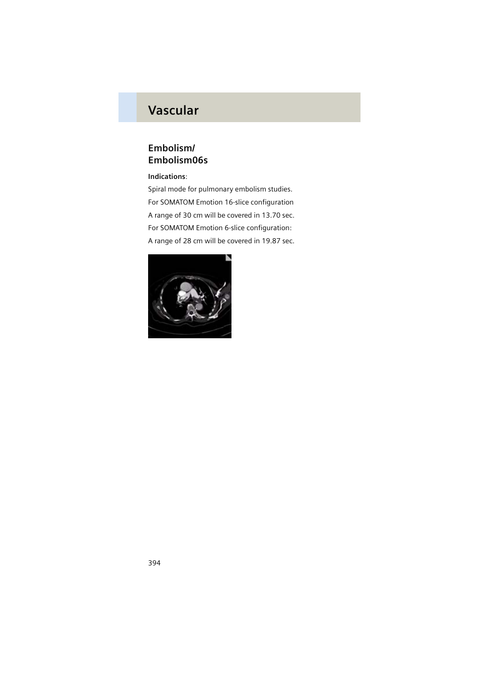 Embolism/ embolism06s, Embolism, Embolism06s 394 | Vascular | Siemens EMOTION 16-Jun User Manual | Page 394 / 590