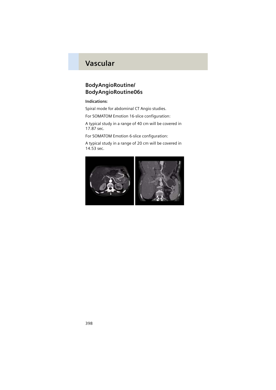 Bodyangioroutine/ bodyangioroutine06s, Bodyangioroutine, Bodyangioroutine06s 398 | Vascular | Siemens EMOTION 16-Jun User Manual | Page 398 / 590