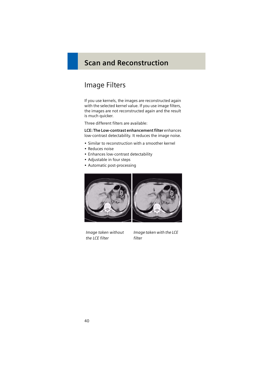 Image filters, Scan and reconstruction image filters | Siemens EMOTION 16-Jun User Manual | Page 40 / 590