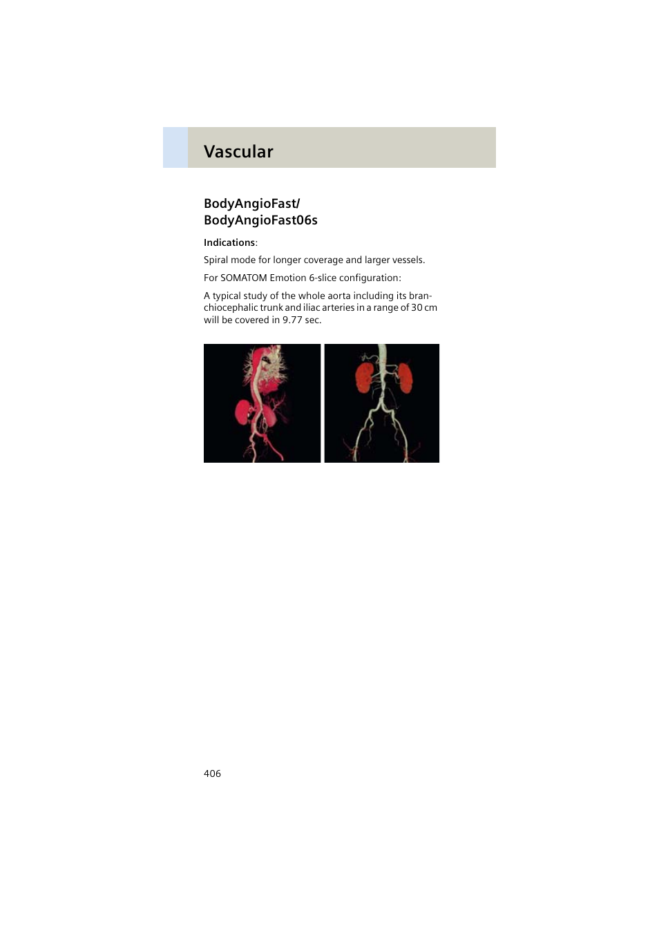 Bodyangiofast/ bodyangiofast06s, Bodyangiofast, Bodyangiofast06s 406 | Vascular | Siemens EMOTION 16-Jun User Manual | Page 406 / 590