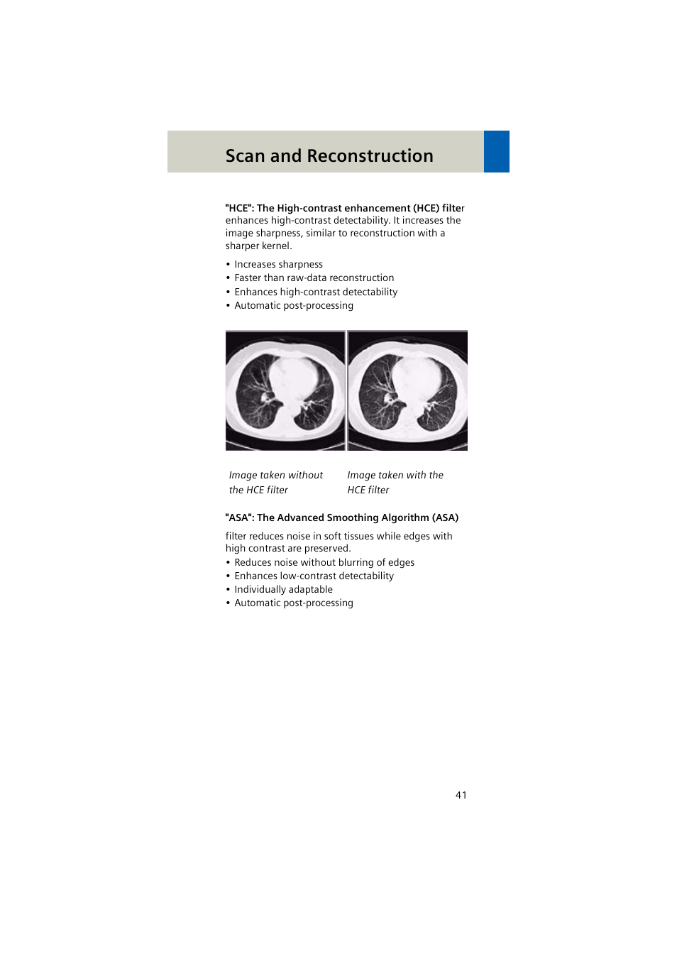 Scan and reconstruction | Siemens EMOTION 16-Jun User Manual | Page 41 / 590