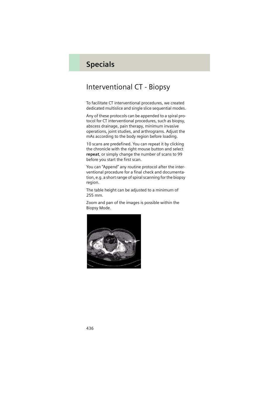 Interventional ct - biopsy, Specials interventional ct - biopsy | Siemens EMOTION 16-Jun User Manual | Page 436 / 590