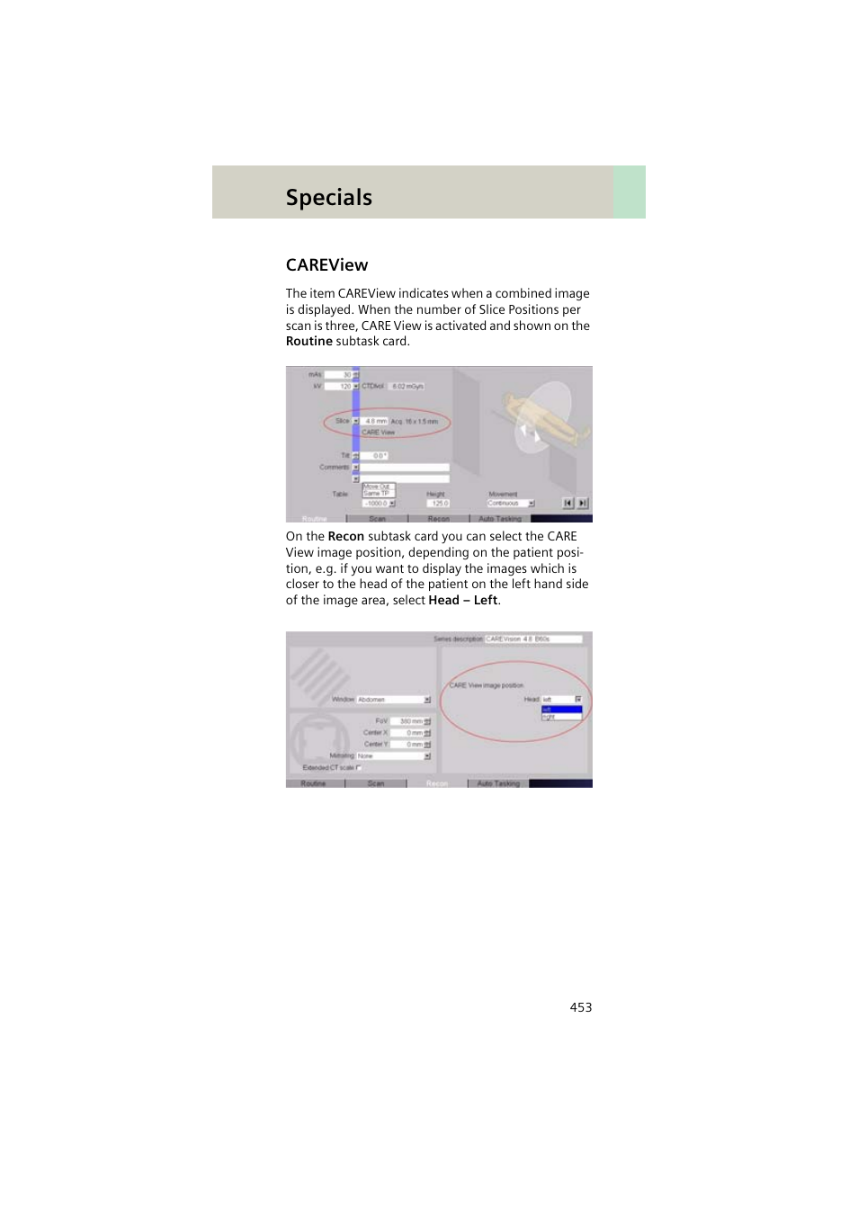 Careview, Careview 453, Specials | Siemens EMOTION 16-Jun User Manual | Page 453 / 590