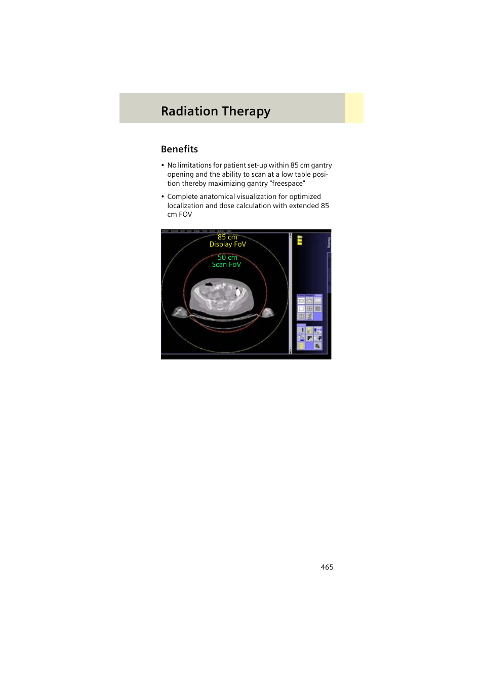 Benefits, Benefits 465, Radiation therapy | Siemens EMOTION 16-Jun User Manual | Page 465 / 590