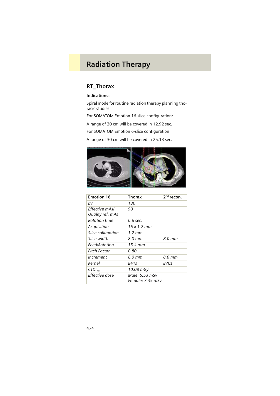 Rt_thorax, Rt_thorax 474, Radiation therapy | Siemens EMOTION 16-Jun User Manual | Page 474 / 590