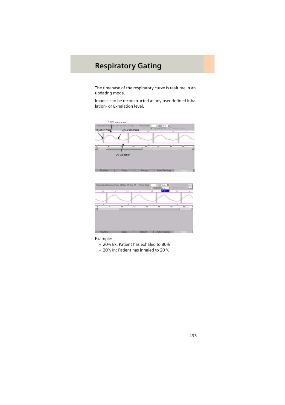 Respiratory gating | Siemens EMOTION 16-Jun User Manual | Page 493 / 590