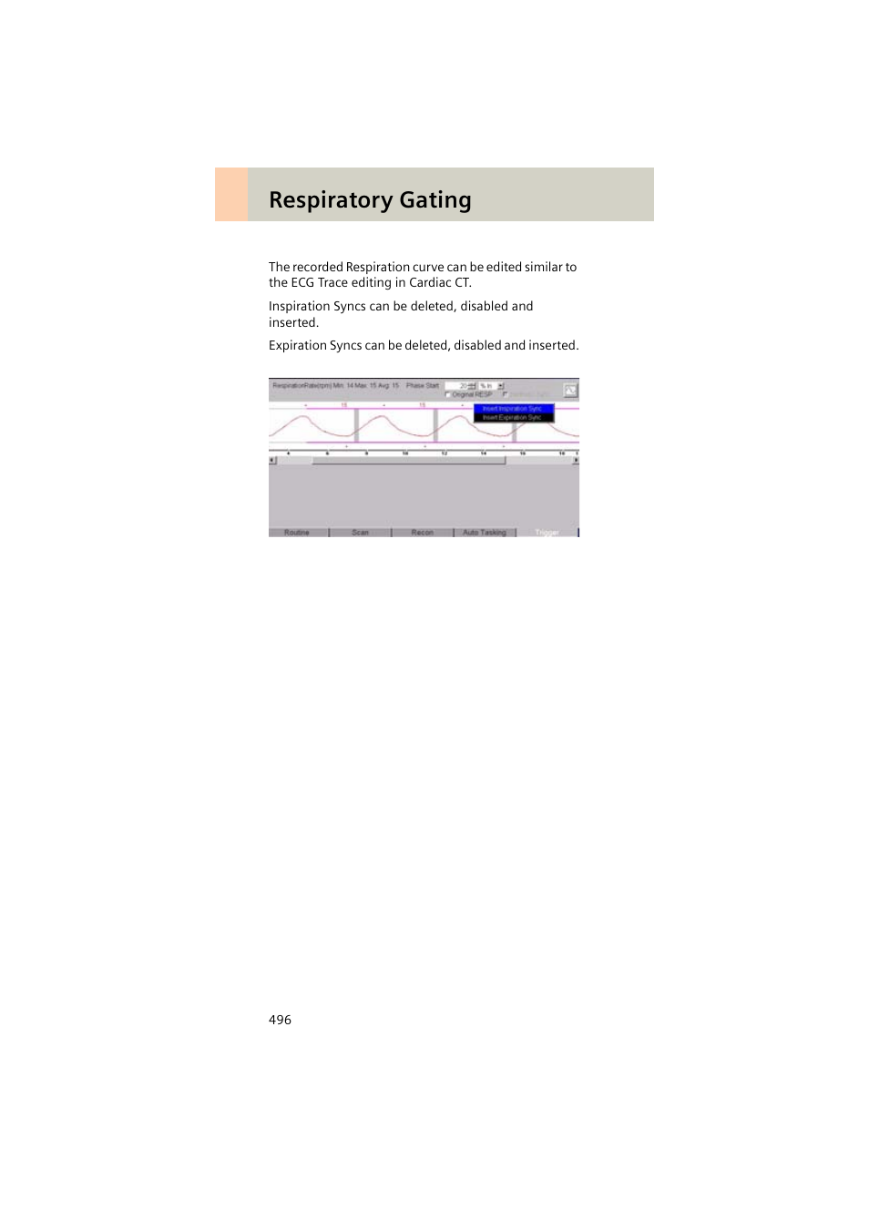 Respiratory gating | Siemens EMOTION 16-Jun User Manual | Page 496 / 590