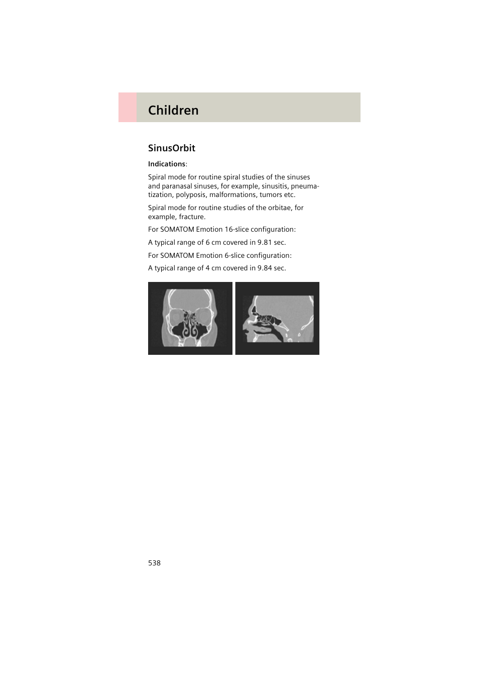 Sinusorbit, Sinusorbit 538, Children | Siemens EMOTION 16-Jun User Manual | Page 538 / 590