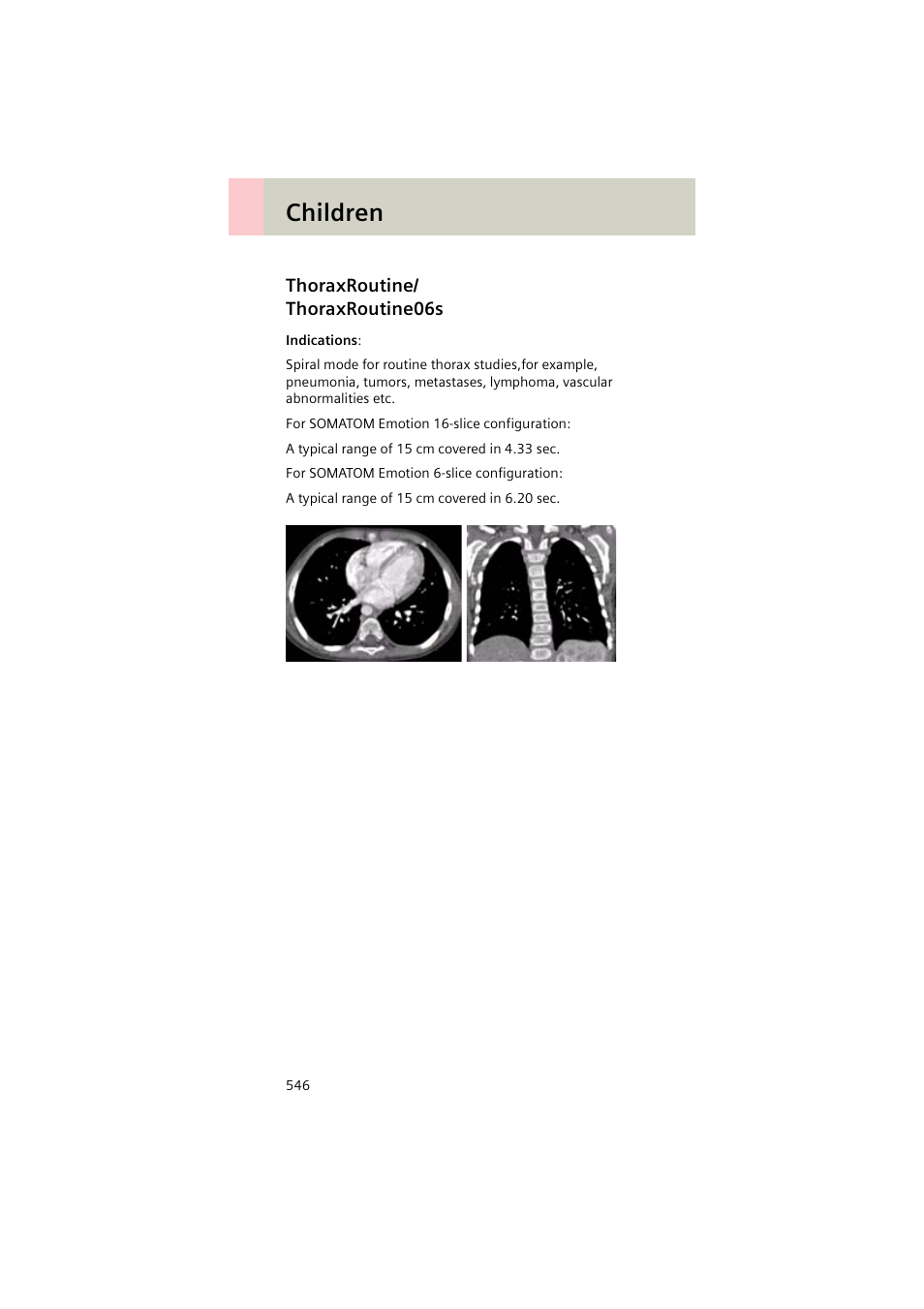 Thoraxroutine/ thoraxroutine06s, Thoraxroutine, Thoraxroutine06s 546 | Children | Siemens EMOTION 16-Jun User Manual | Page 546 / 590