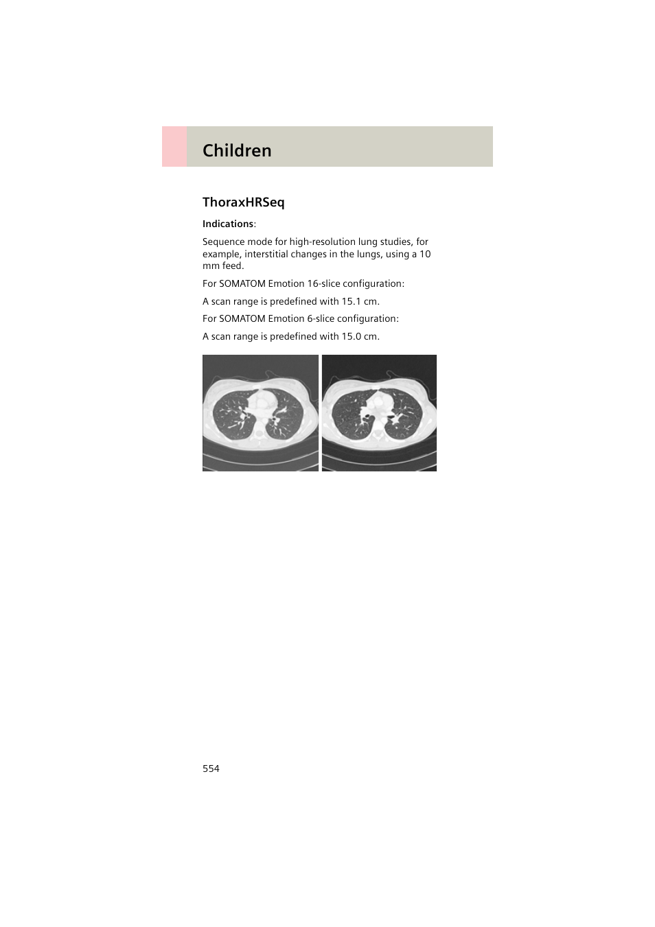 Thoraxhrseq, Thoraxhrseq 554, Children | Siemens EMOTION 16-Jun User Manual | Page 554 / 590