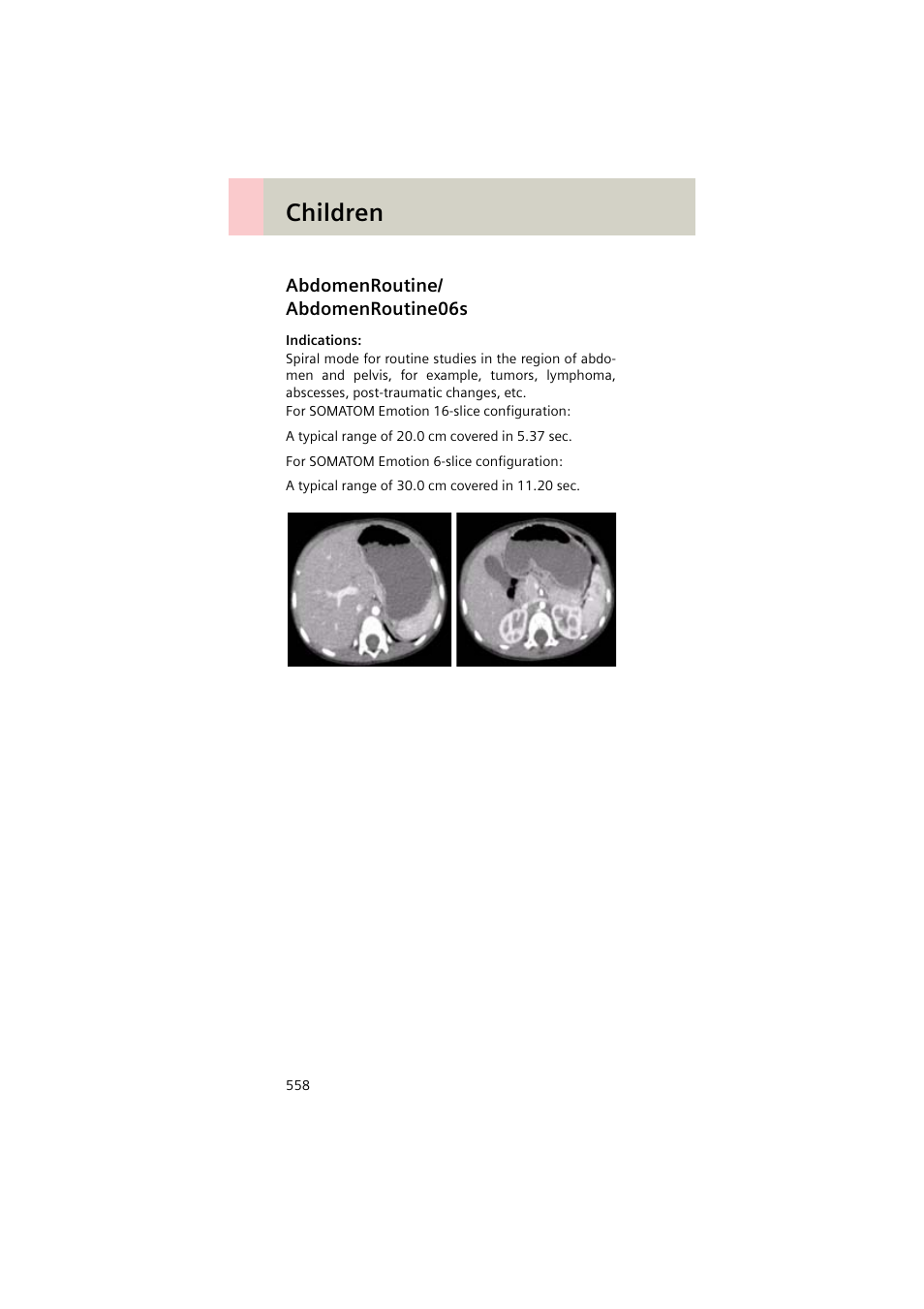 Abdomenroutine/ abdomenroutine06s, Abdomenroutine, Abdomenroutine06s 558 | Children | Siemens EMOTION 16-Jun User Manual | Page 558 / 590