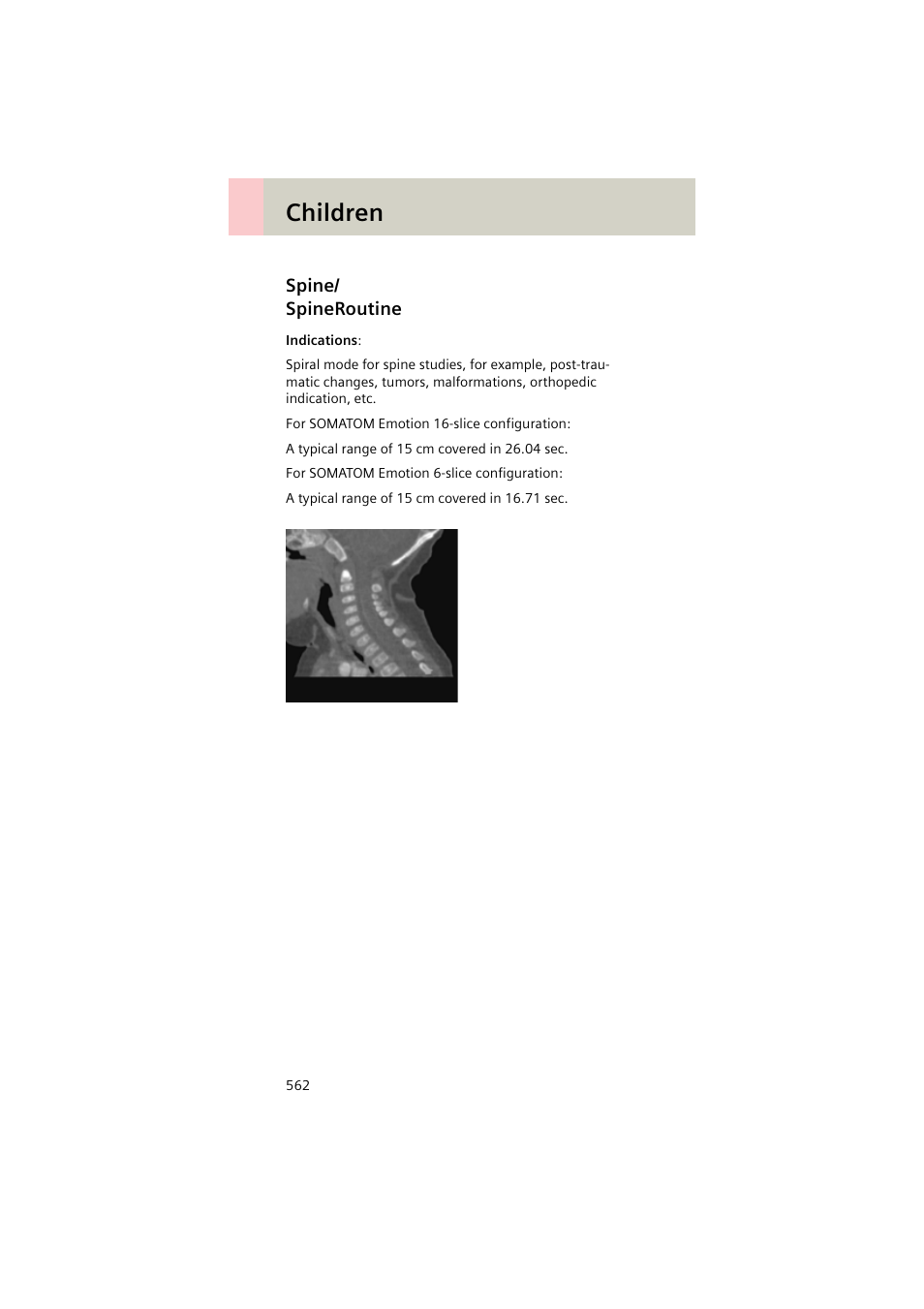 Spine/ spineroutine, Spine, Spineroutine 562 | Children | Siemens EMOTION 16-Jun User Manual | Page 562 / 590