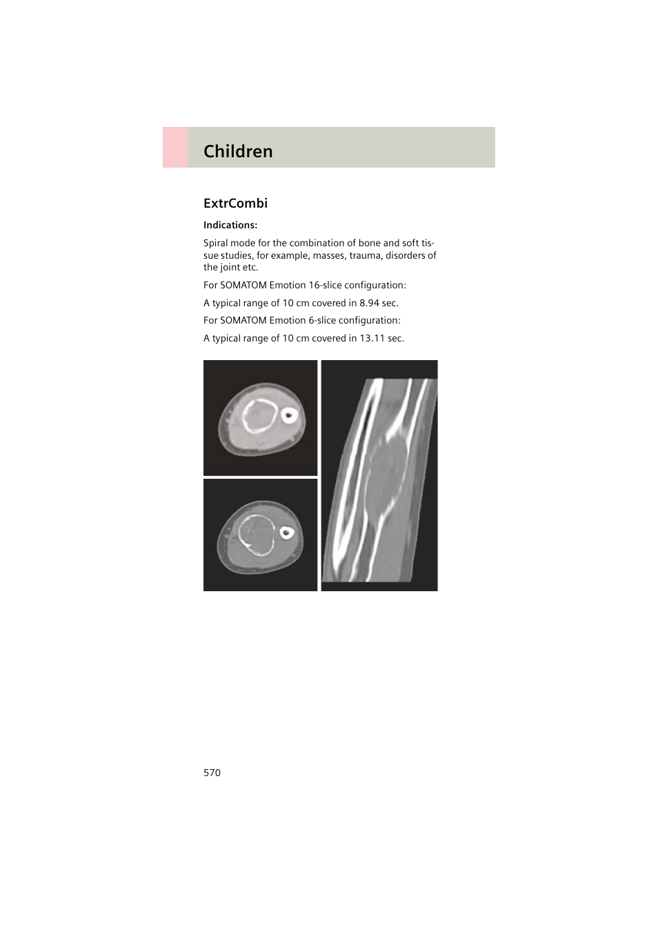 Extrcombi, Extrcombi 570, Children | Siemens EMOTION 16-Jun User Manual | Page 570 / 590