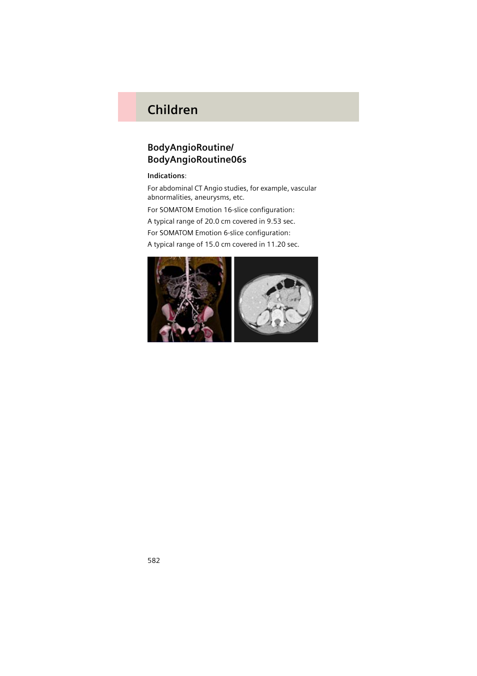 Bodyangioroutine/ bodyangioroutine06s, Bodyangioroutine, Bodyangioroutine06s 582 | Children | Siemens EMOTION 16-Jun User Manual | Page 582 / 590