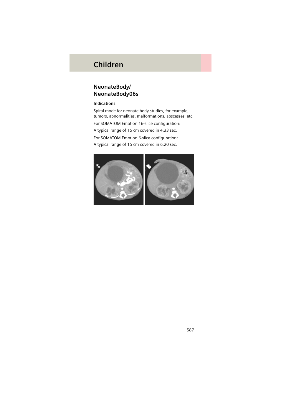 Neonatebody/ neonatebody06s, Neonatebody, Neonatebody06s 587 | Children | Siemens EMOTION 16-Jun User Manual | Page 587 / 590