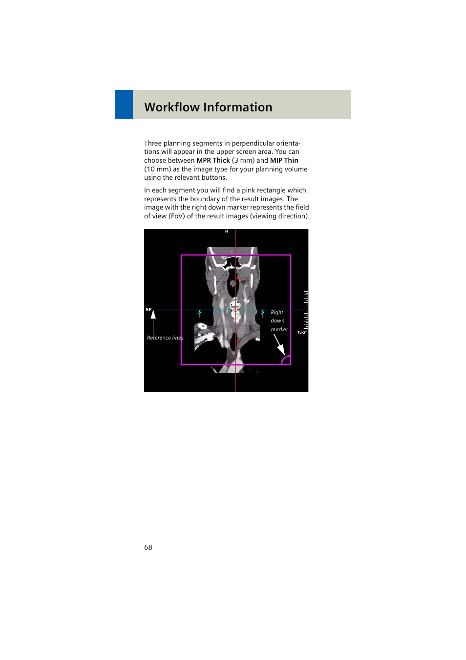 Workflow information | Siemens EMOTION 16-Jun User Manual | Page 68 / 590