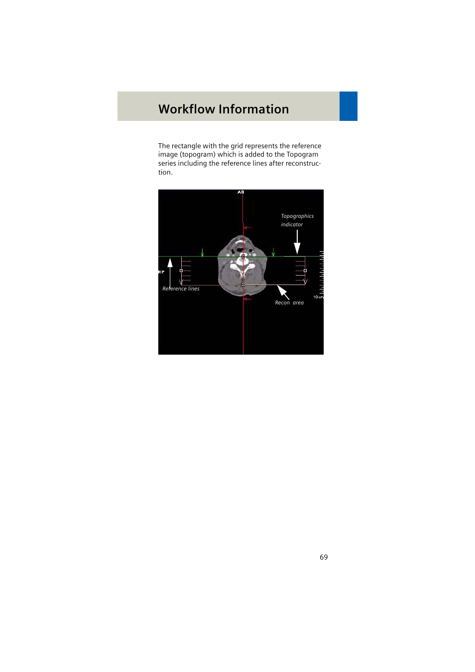 Workflow information | Siemens EMOTION 16-Jun User Manual | Page 69 / 590