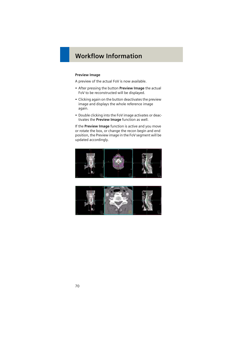 Workflow information | Siemens EMOTION 16-Jun User Manual | Page 70 / 590