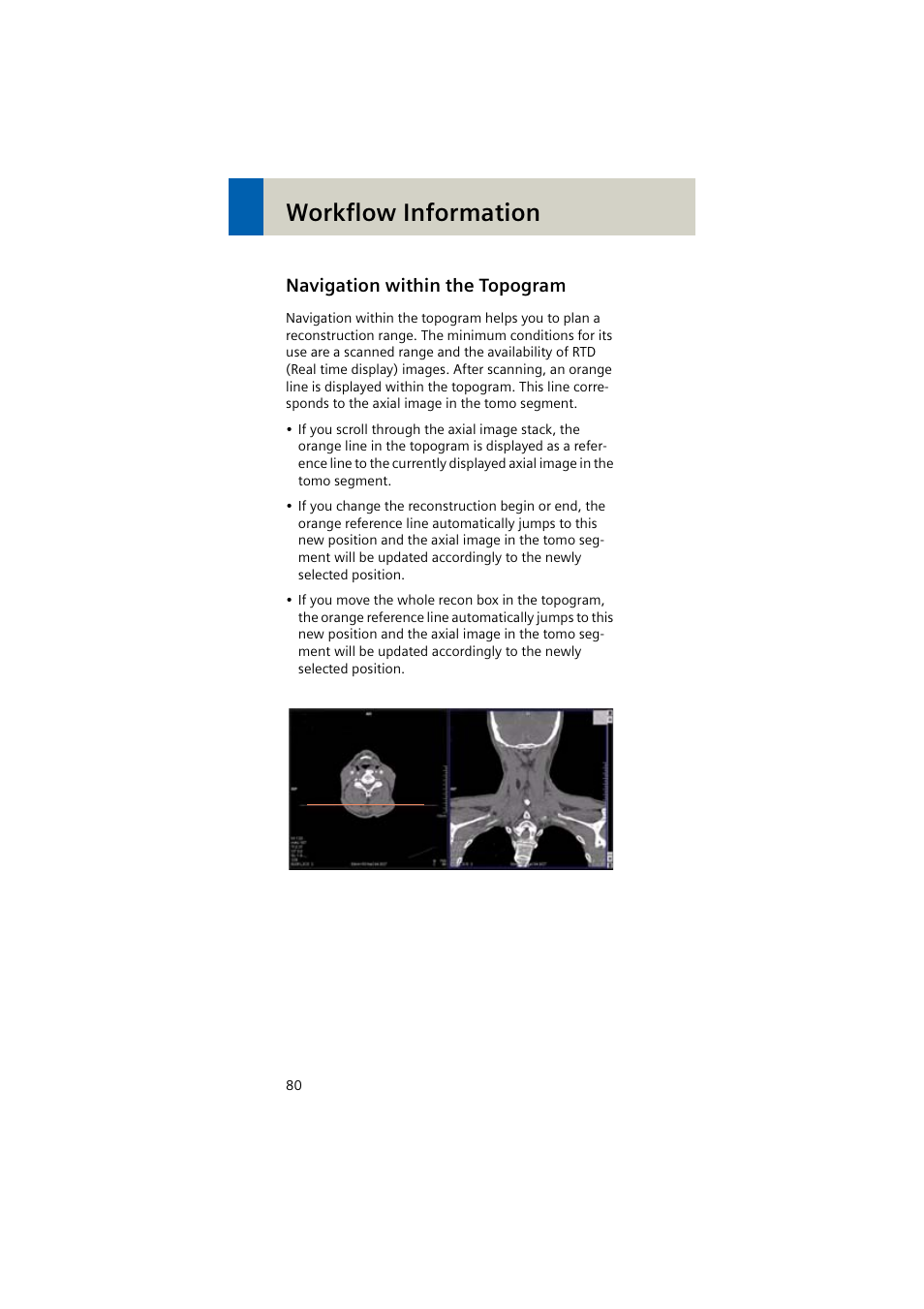 Navigation within the topogram, Workflow information | Siemens EMOTION 16-Jun User Manual | Page 80 / 590