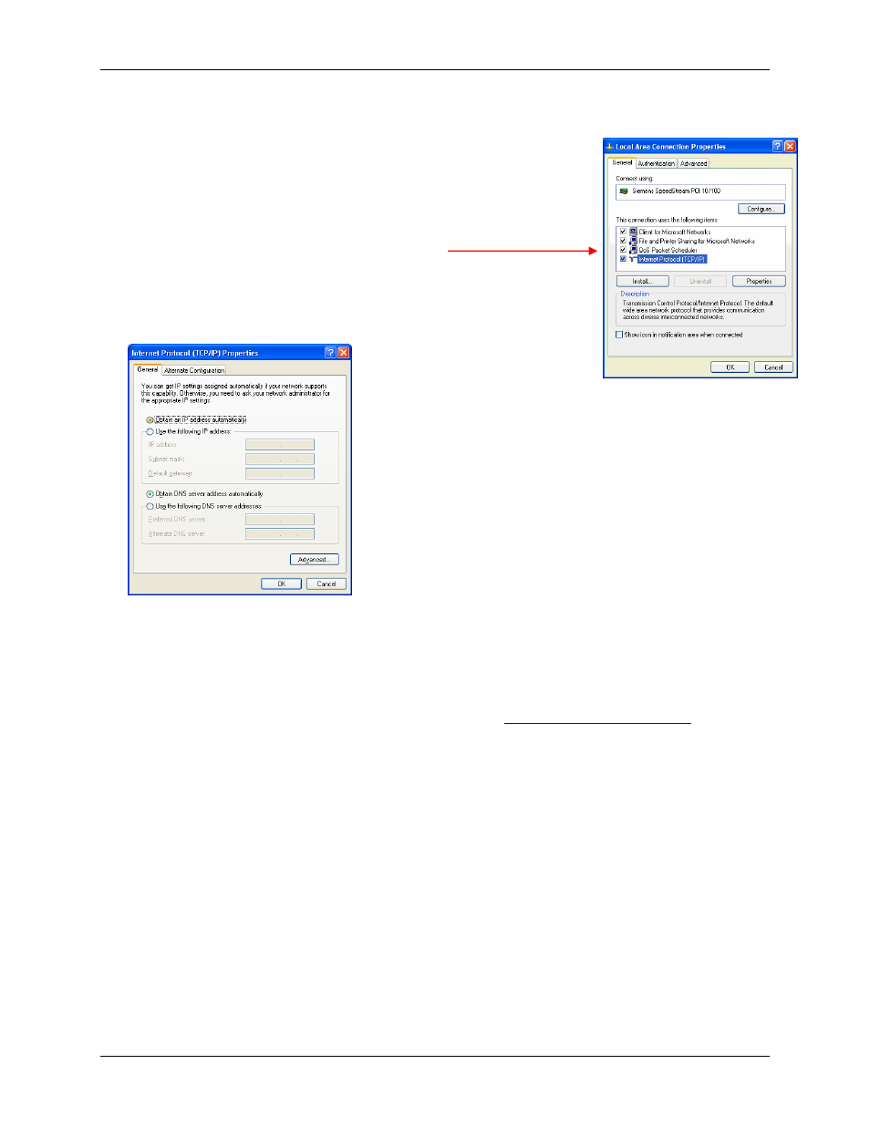 Checking tcp/ip settings (windows xp), Windows xp | Siemens SpeedStream 5450 User Manual | Page 17 / 83