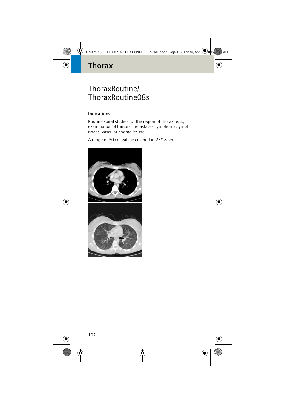 Thoraxroutine/ thoraxroutine08s, Thoraxroutine/thoraxroutine08s, Thorax thoraxroutine/ thoraxroutine08s | Siemens syngo CT 2005C User Manual | Page 102 / 321