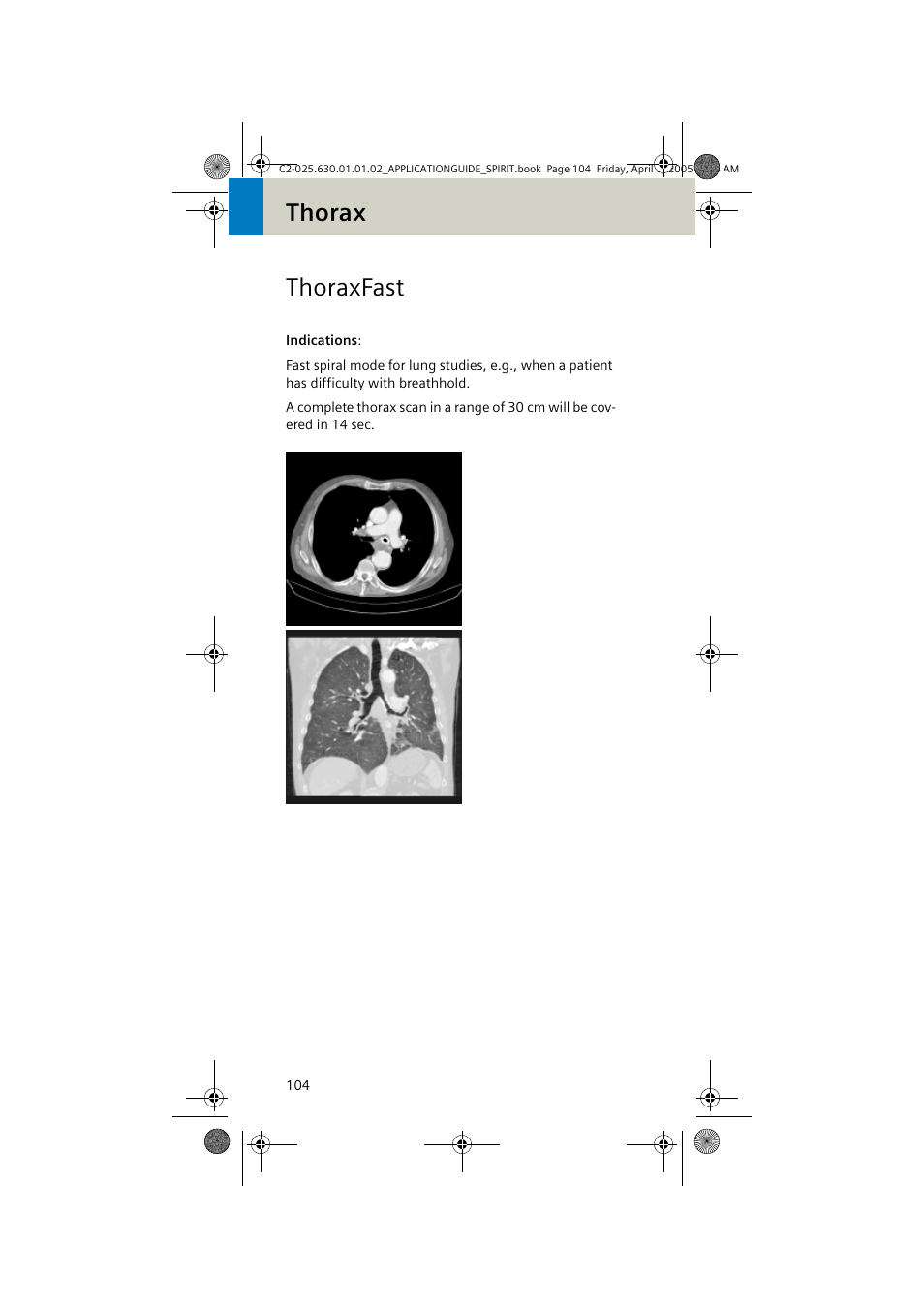 Thoraxfast, Thorax thoraxfast | Siemens syngo CT 2005C User Manual | Page 104 / 321