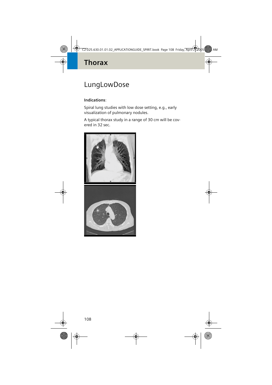Lunglowdose, Thorax lunglowdose | Siemens syngo CT 2005C User Manual | Page 108 / 321