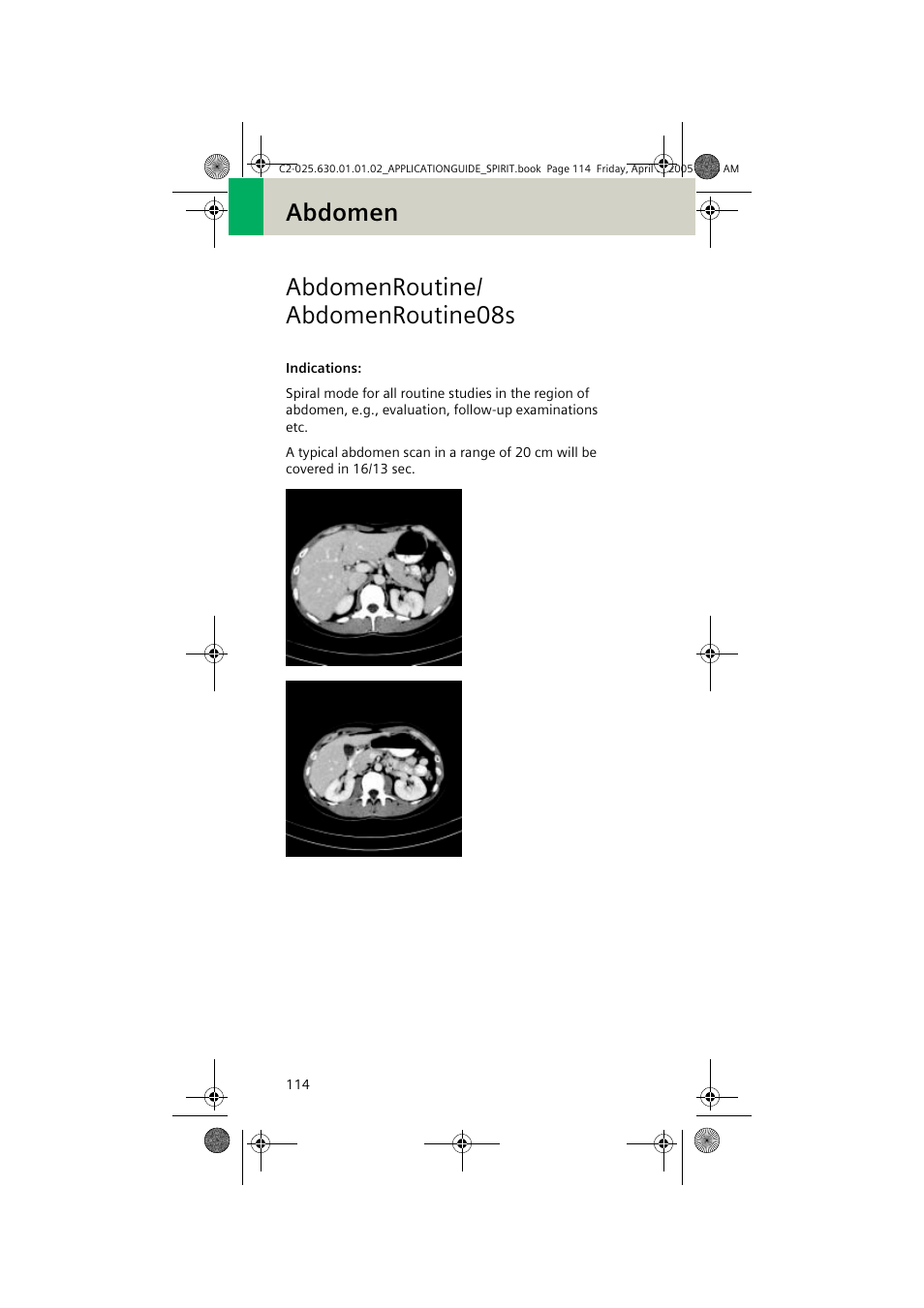 Abdomenroutine/ abdomenroutine08s, Abdomenroutine/abdomenroutine08s, Abdomen abdomenroutine/ abdomenroutine08s | Siemens syngo CT 2005C User Manual | Page 114 / 321