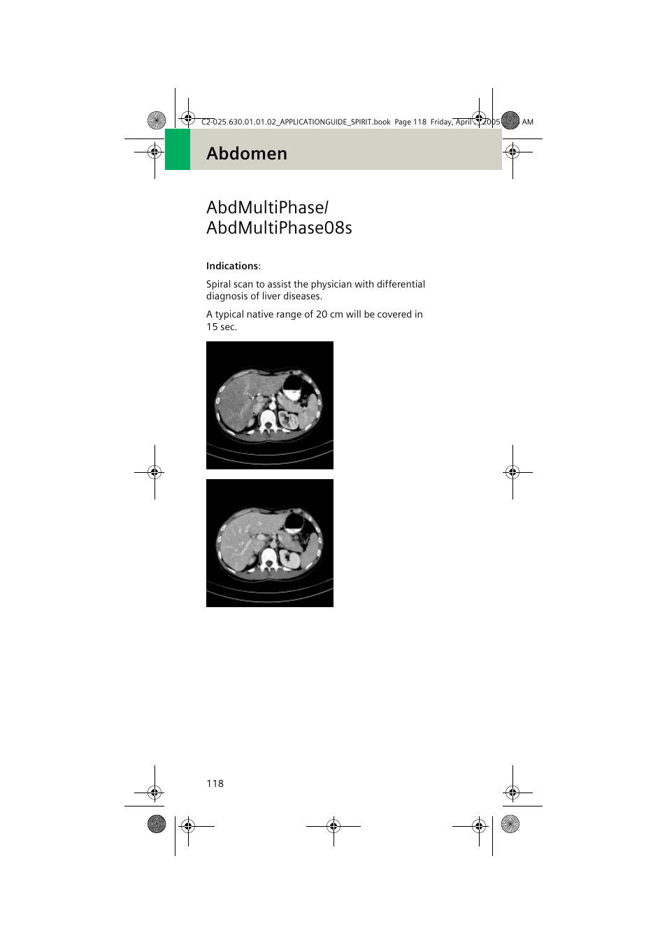 Abdmultiphase/ abdmultiphase08s, Abdmultiphase/abdmultiphase08s, Abdomen abdmultiphase/ abdmultiphase08s | Siemens syngo CT 2005C User Manual | Page 118 / 321