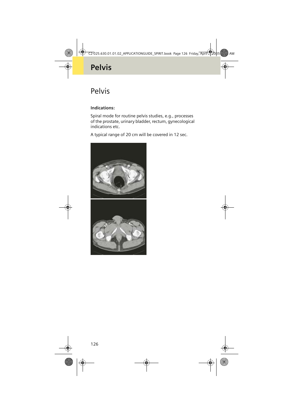 Pelvis | Siemens syngo CT 2005C User Manual | Page 126 / 321