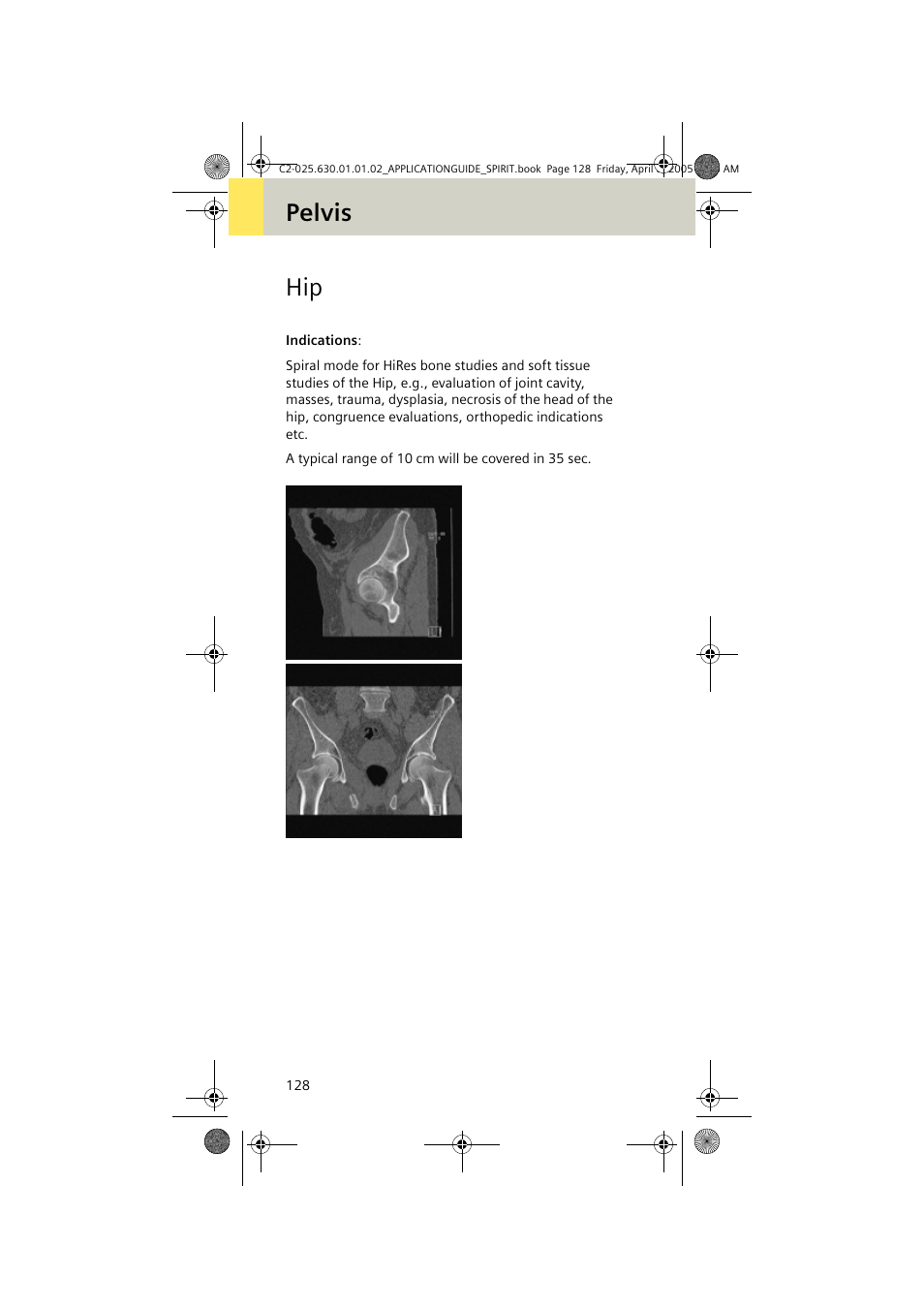 Pelvis hip | Siemens syngo CT 2005C User Manual | Page 128 / 321