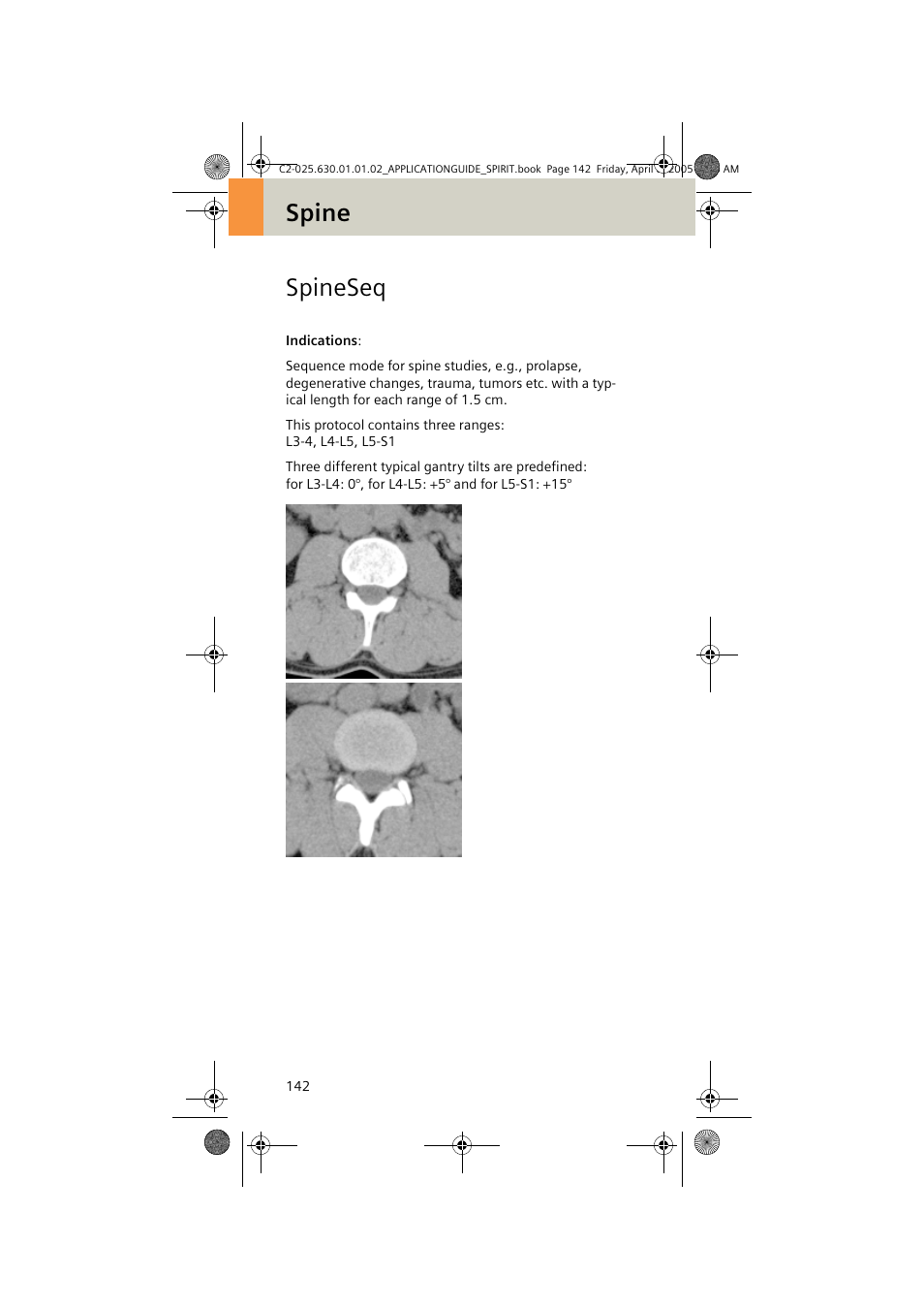 Spineseq, Spine spineseq | Siemens syngo CT 2005C User Manual | Page 142 / 321