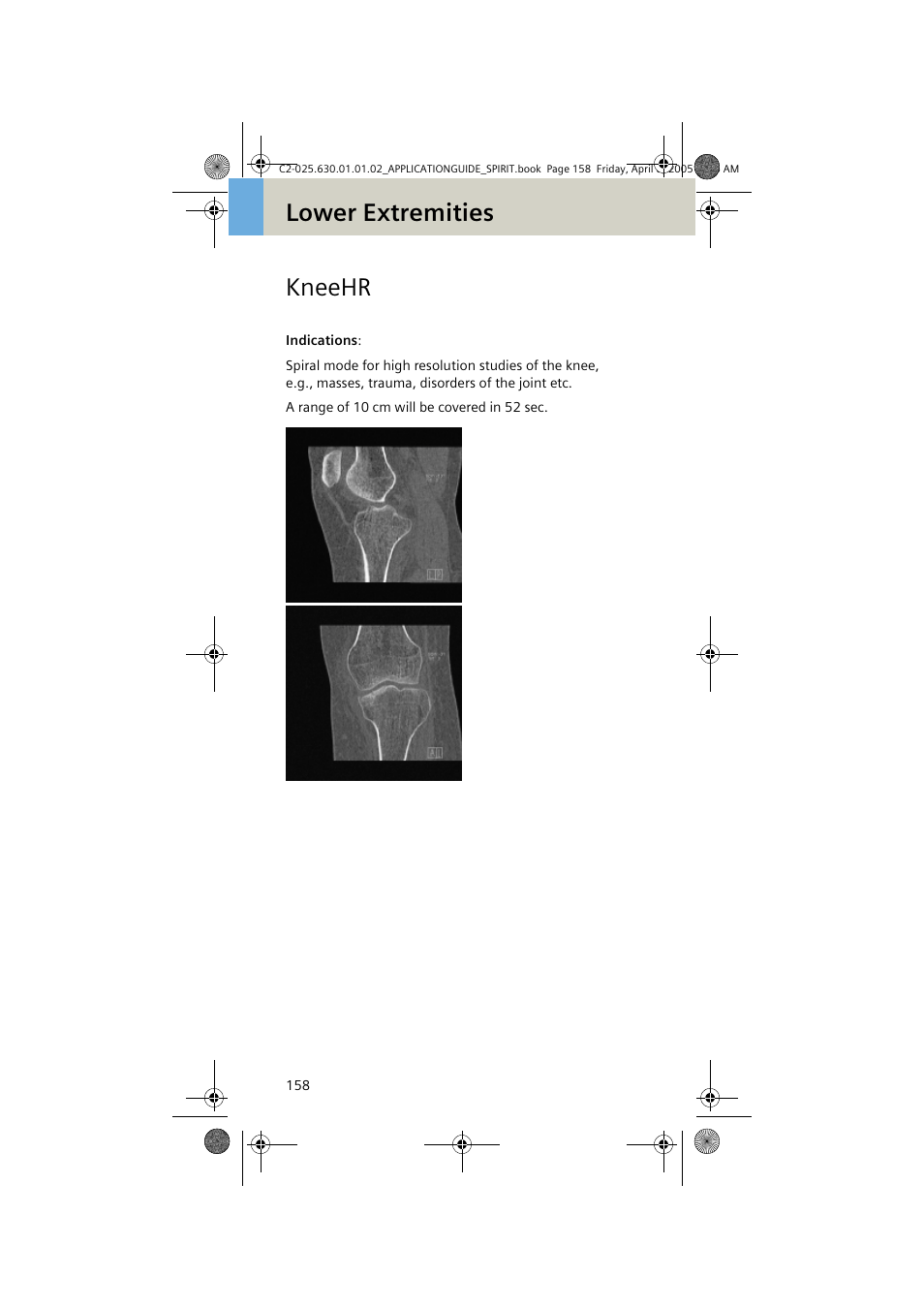 Kneehr, Lower extremities kneehr | Siemens syngo CT 2005C User Manual | Page 158 / 321