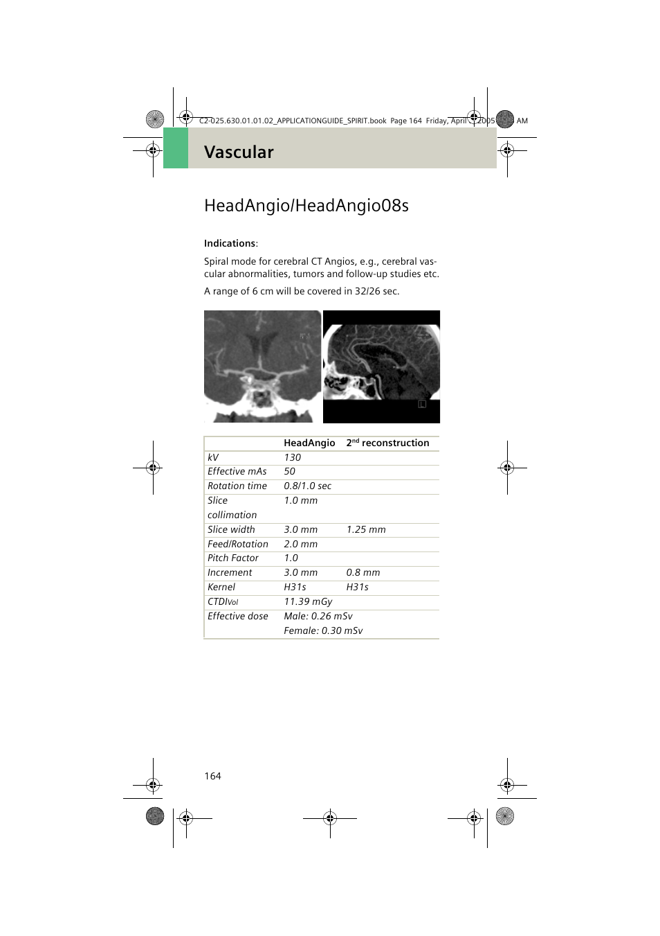 Headangio/headangio08s, Vascular headangio/headangio08s | Siemens syngo CT 2005C User Manual | Page 164 / 321