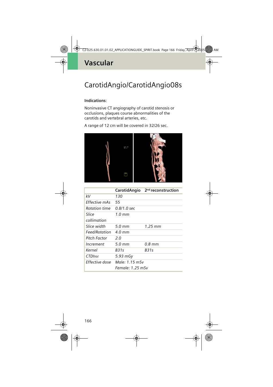 Carotidangio/carotidangio08s, Vascular carotidangio/carotidangio08s | Siemens syngo CT 2005C User Manual | Page 166 / 321