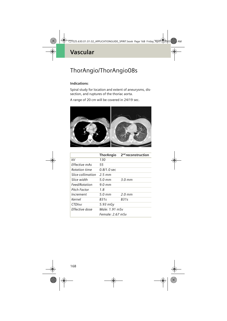 Thorangio/thorangio08s, Vascular thorangio/thorangio08s | Siemens syngo CT 2005C User Manual | Page 168 / 321