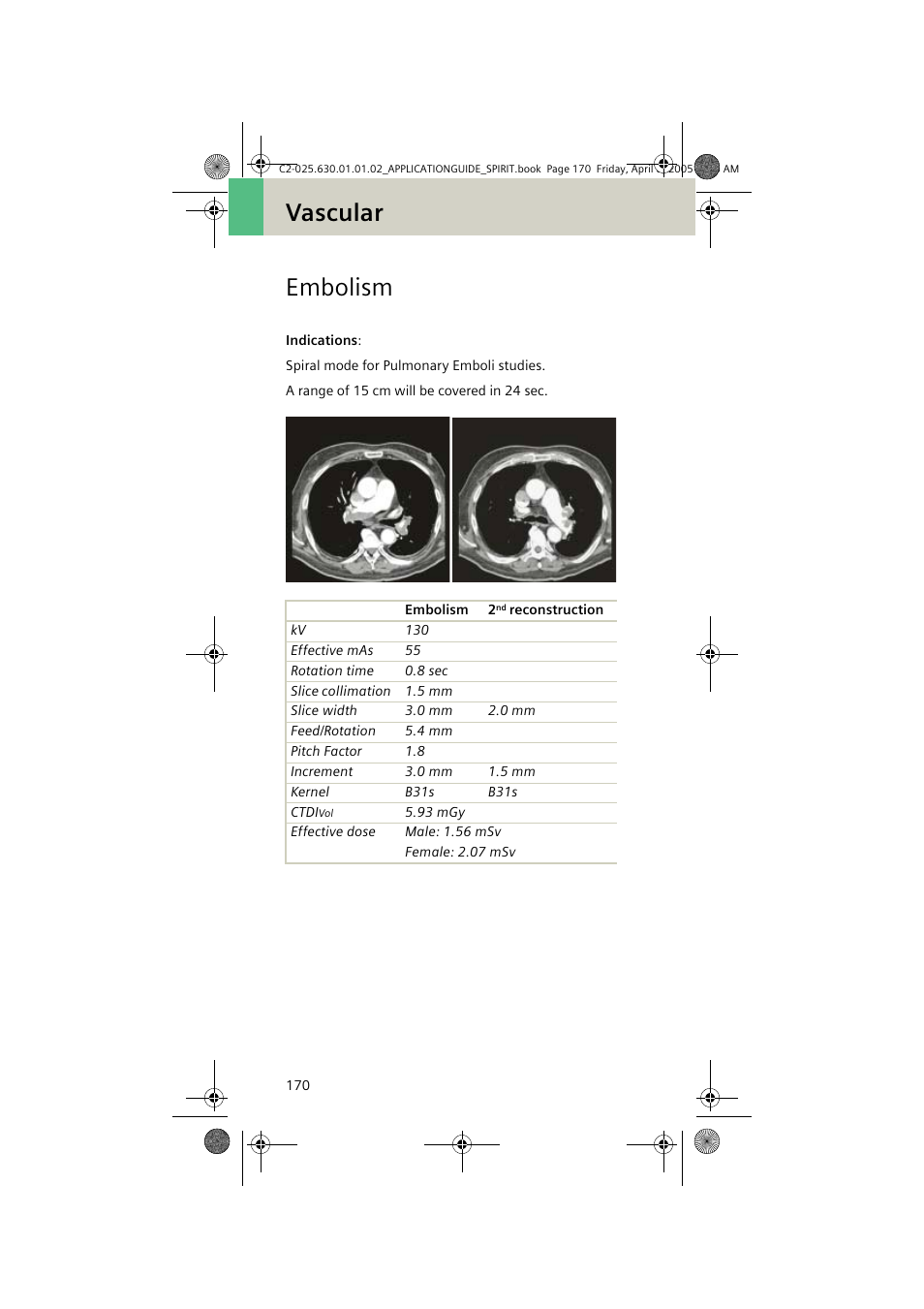 Embolism, Vascular embolism | Siemens syngo CT 2005C User Manual | Page 170 / 321