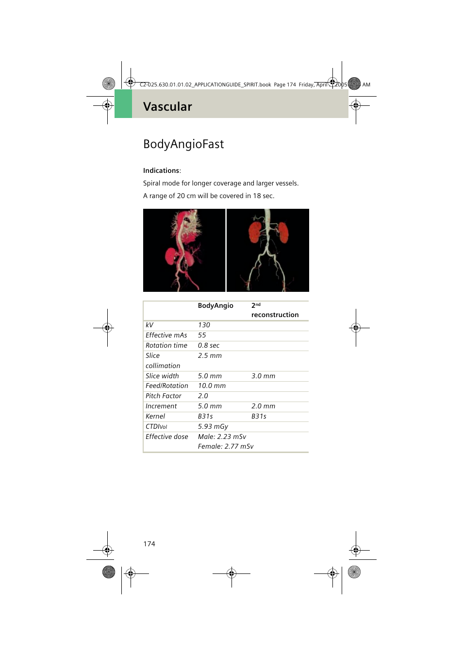 Bodyangiofast, Vascular bodyangiofast | Siemens syngo CT 2005C User Manual | Page 174 / 321